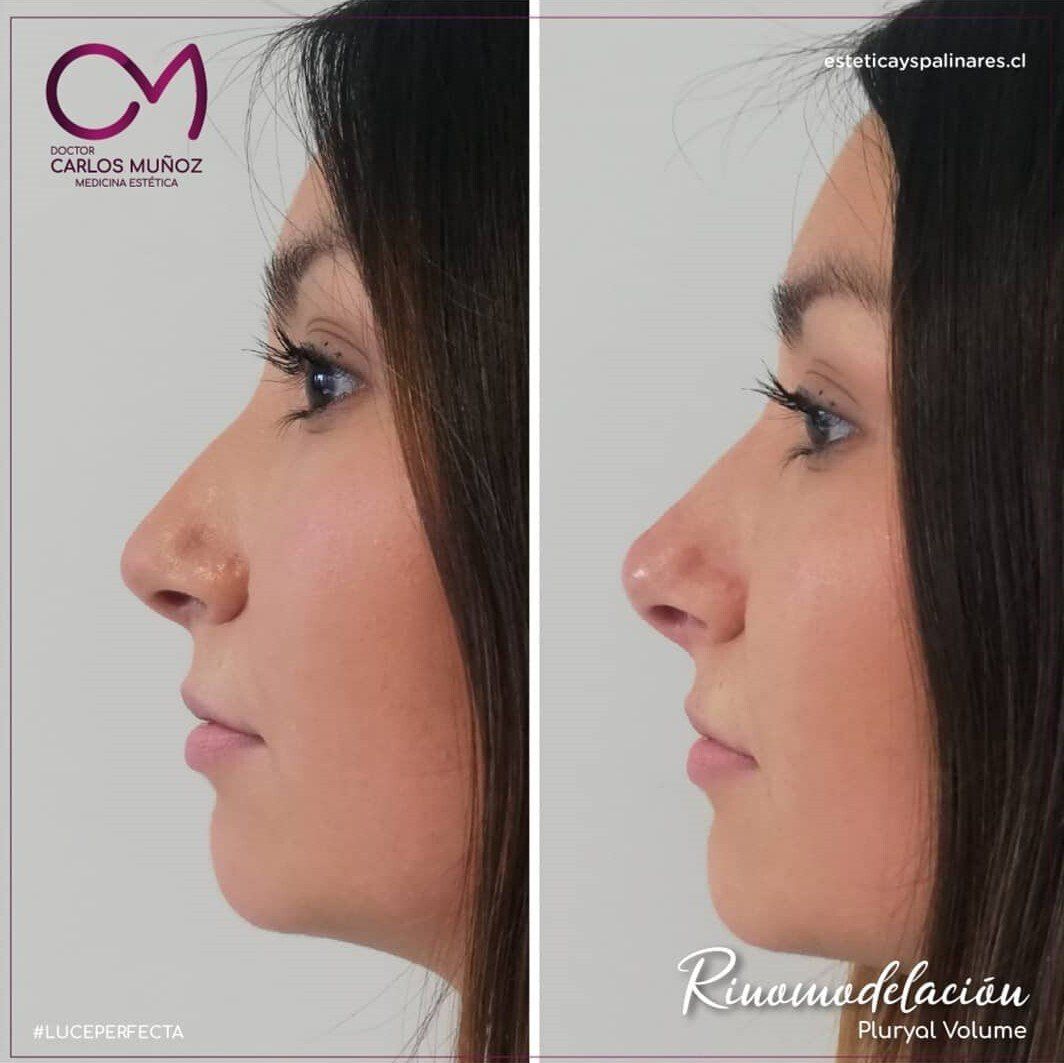 Dr. Carlos Muñoz Medicina estética