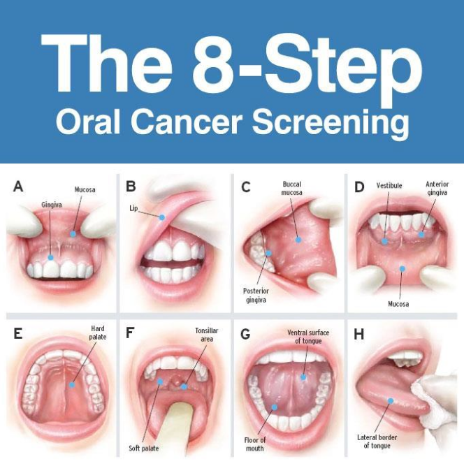 Oral Cancer Screening Campaign 0633