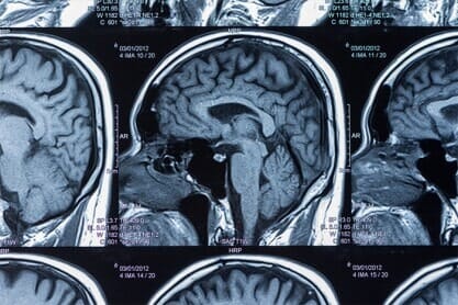 Scans used by a neuro surgeon in Irving, TX