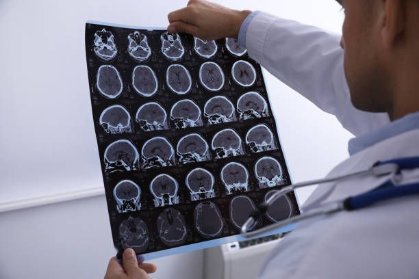 Doctor reviewing brain MRI scans for neurological diagnosis and treatment in clinical setting.