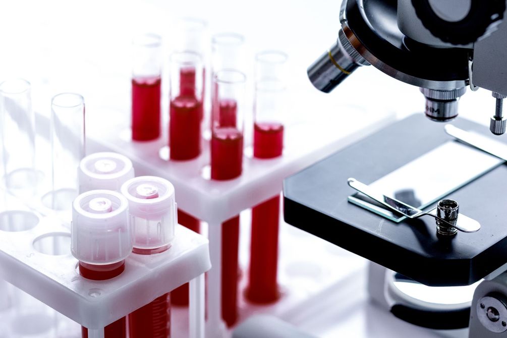 campioni di sangue per test di laboratorio
