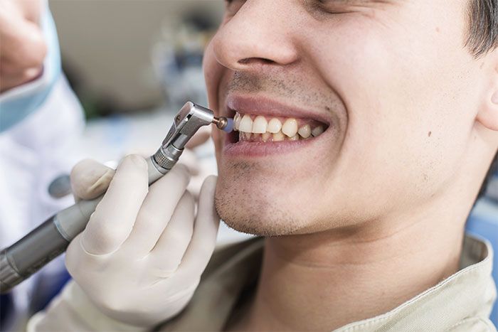 LIMPIEZA DENTAL