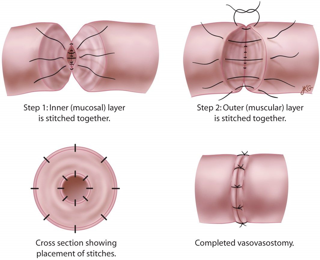 Urology Associates Consultation