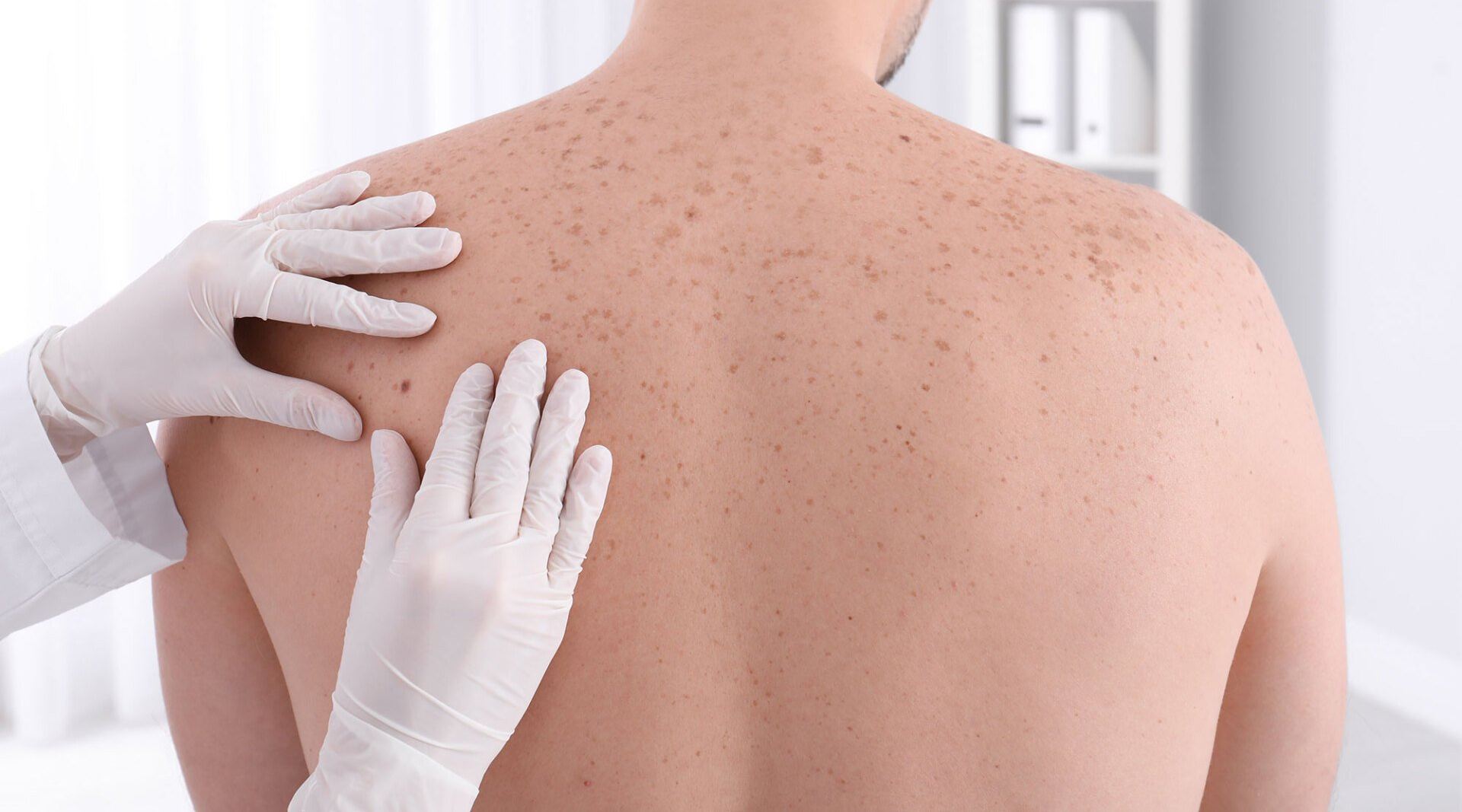 DERMATOLOGIA ONCOLOGICA