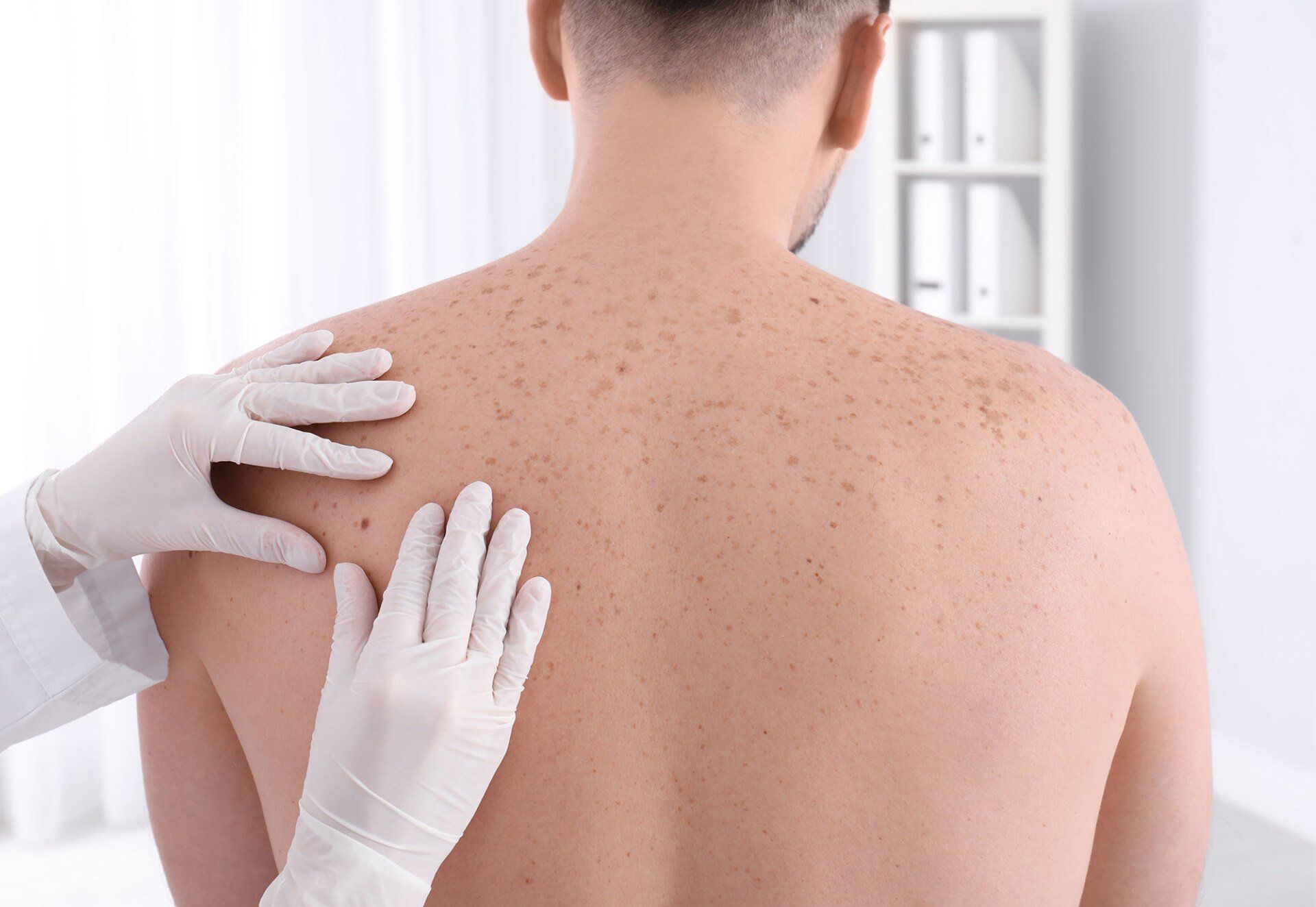 Intervento dermatologo