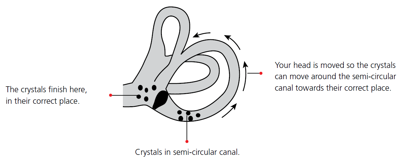 In Your Ear Crystals Symptoms