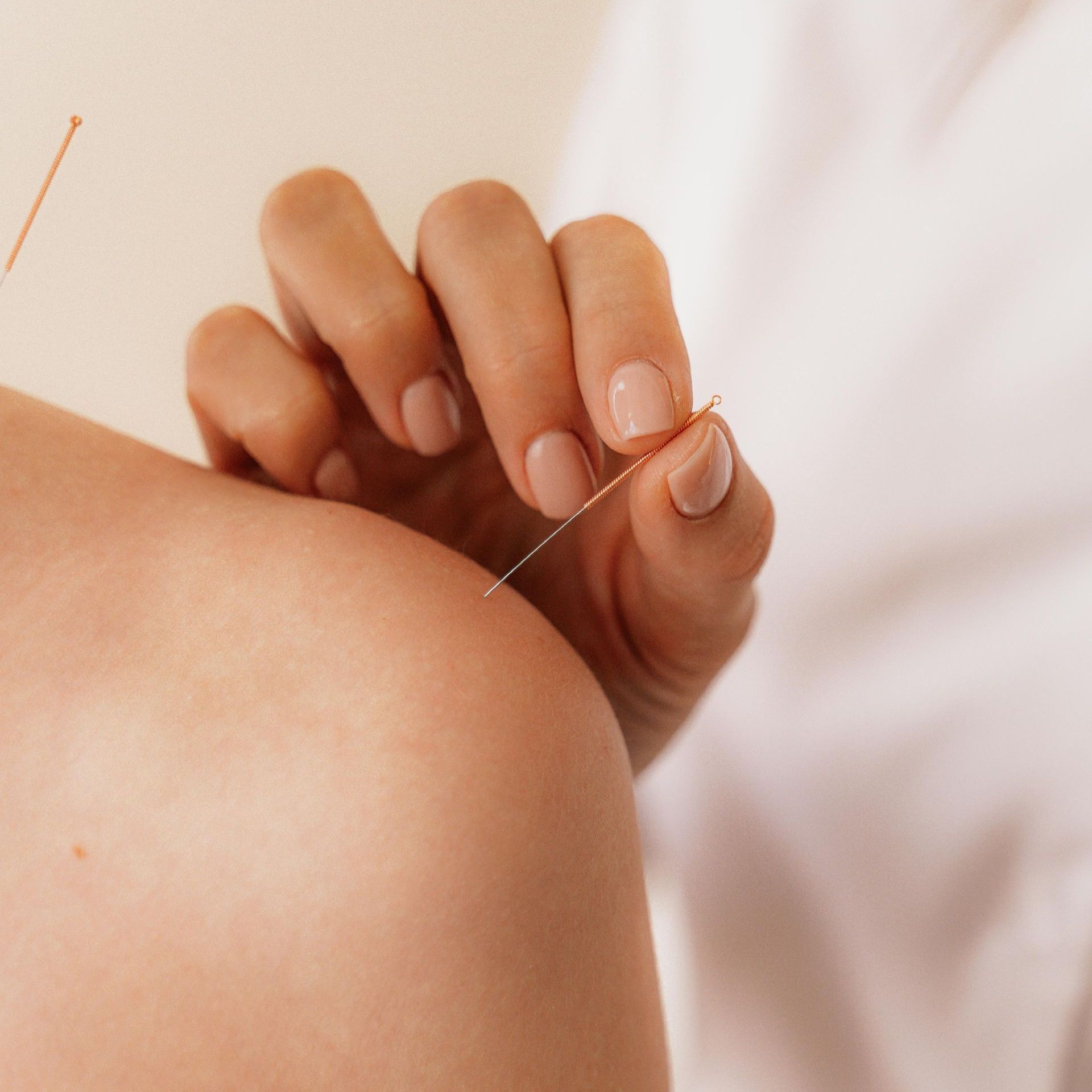 A person is getting acupuncture on their shoulder