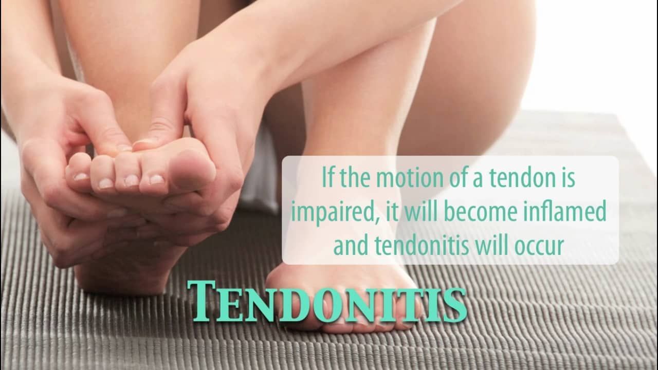Tendonitis