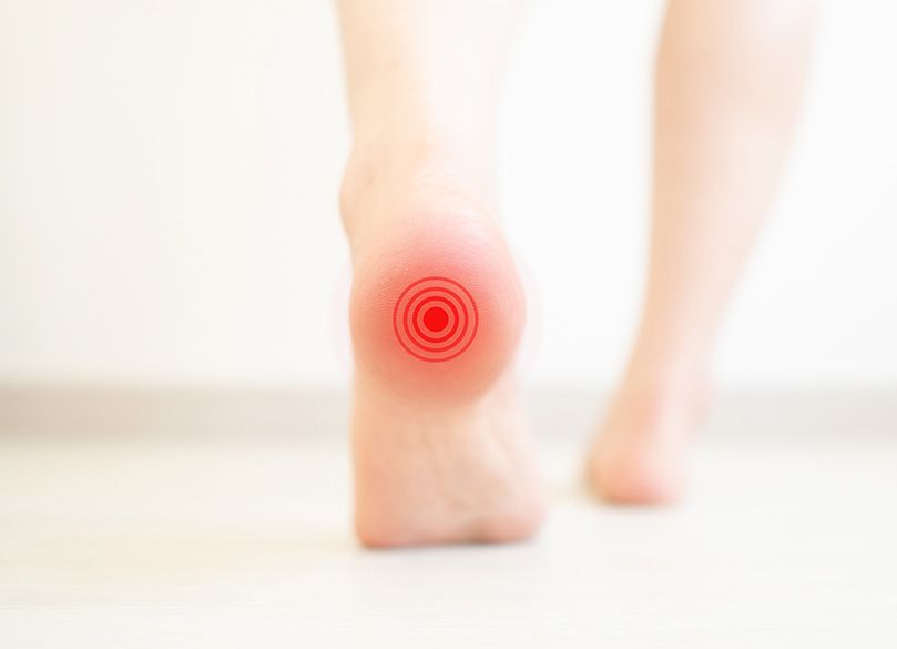 Heel Bursitis