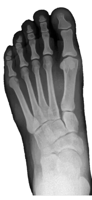 Podiatry X-Ray