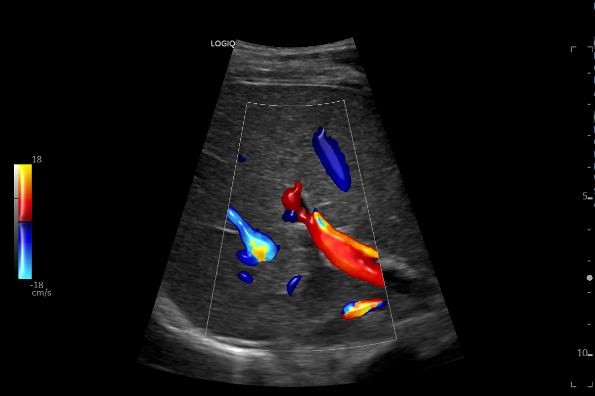 CT Scan for Liver | Radiant Flow