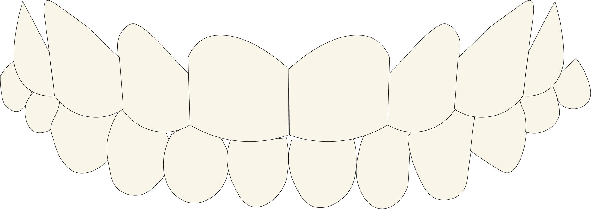 Discolored Teeth