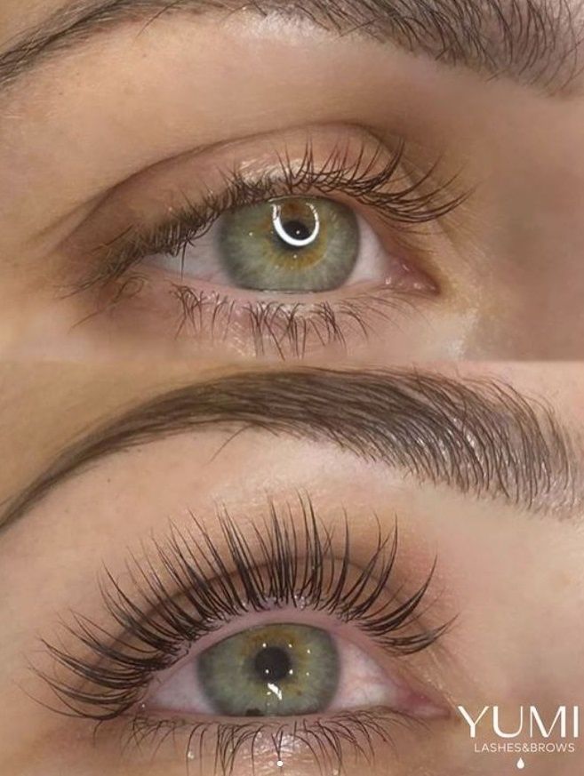 Une photo avant et après des cils d'une femme.