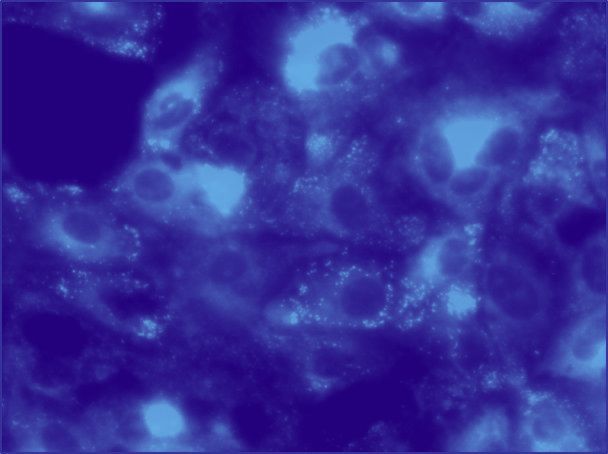 Confocal microscopy image of cells.
