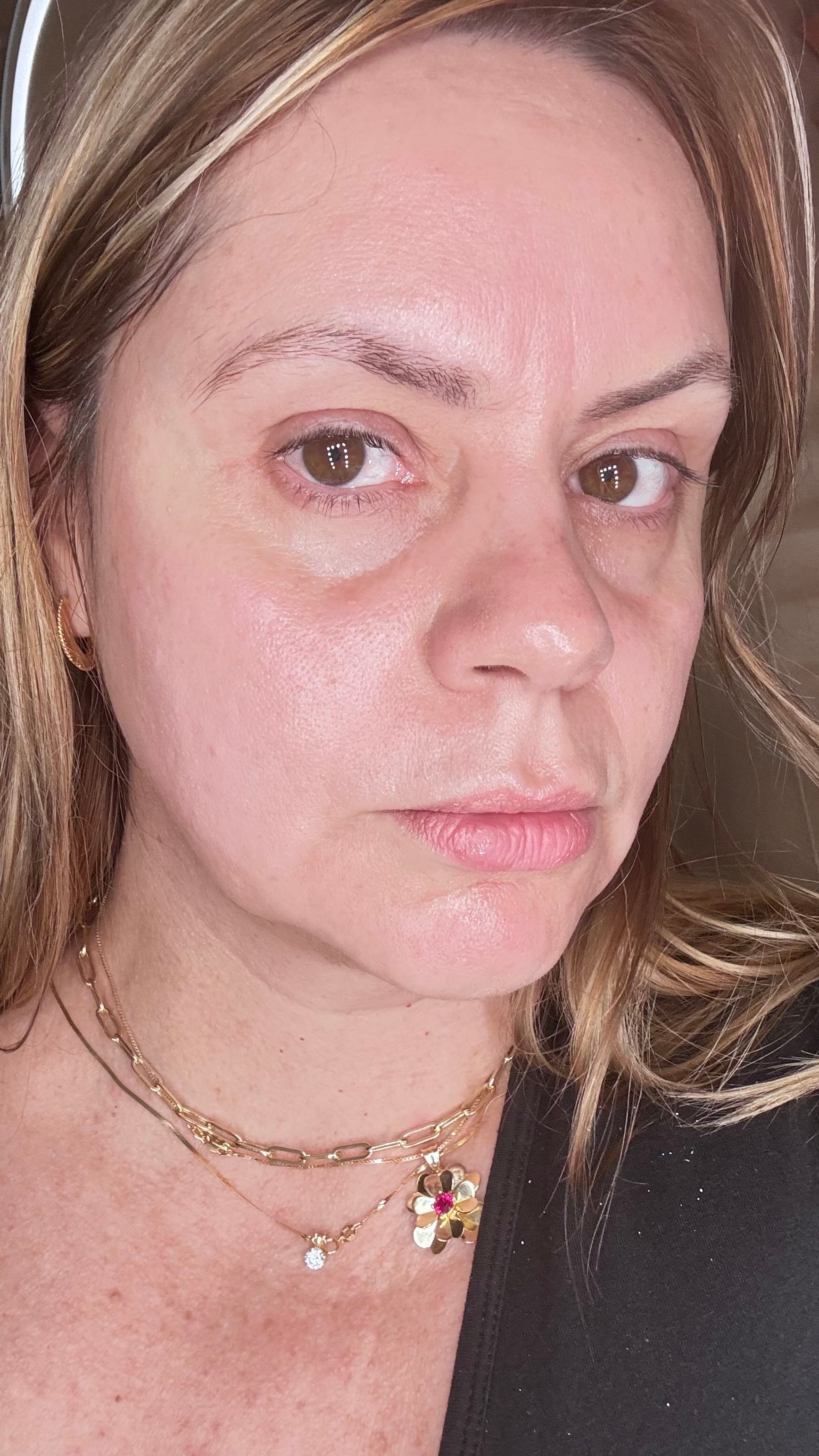 Woman looking directly at the camera, wearing layered necklaces and a dark top. Skin appears slightly oily.