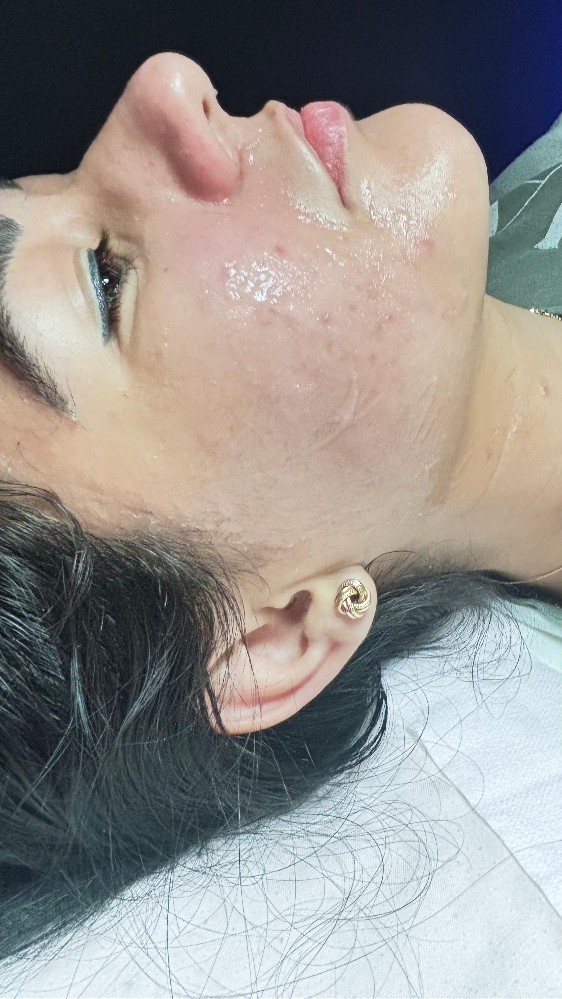 Person with skin care product on face; side profile. Gold earring. Slightly open mouth, looking up.