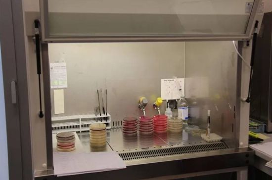 campioni di urinocoltura