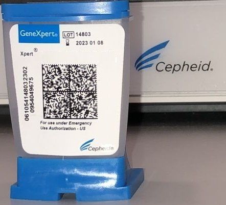 Xpert Bladder Cancer Detection