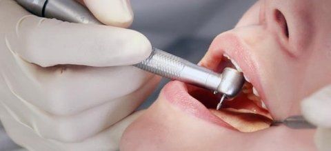 chirurgia conservativa