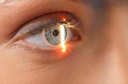 DRA. KATHIA OLIVER FERNÁNDEZ - ESTRABISMO