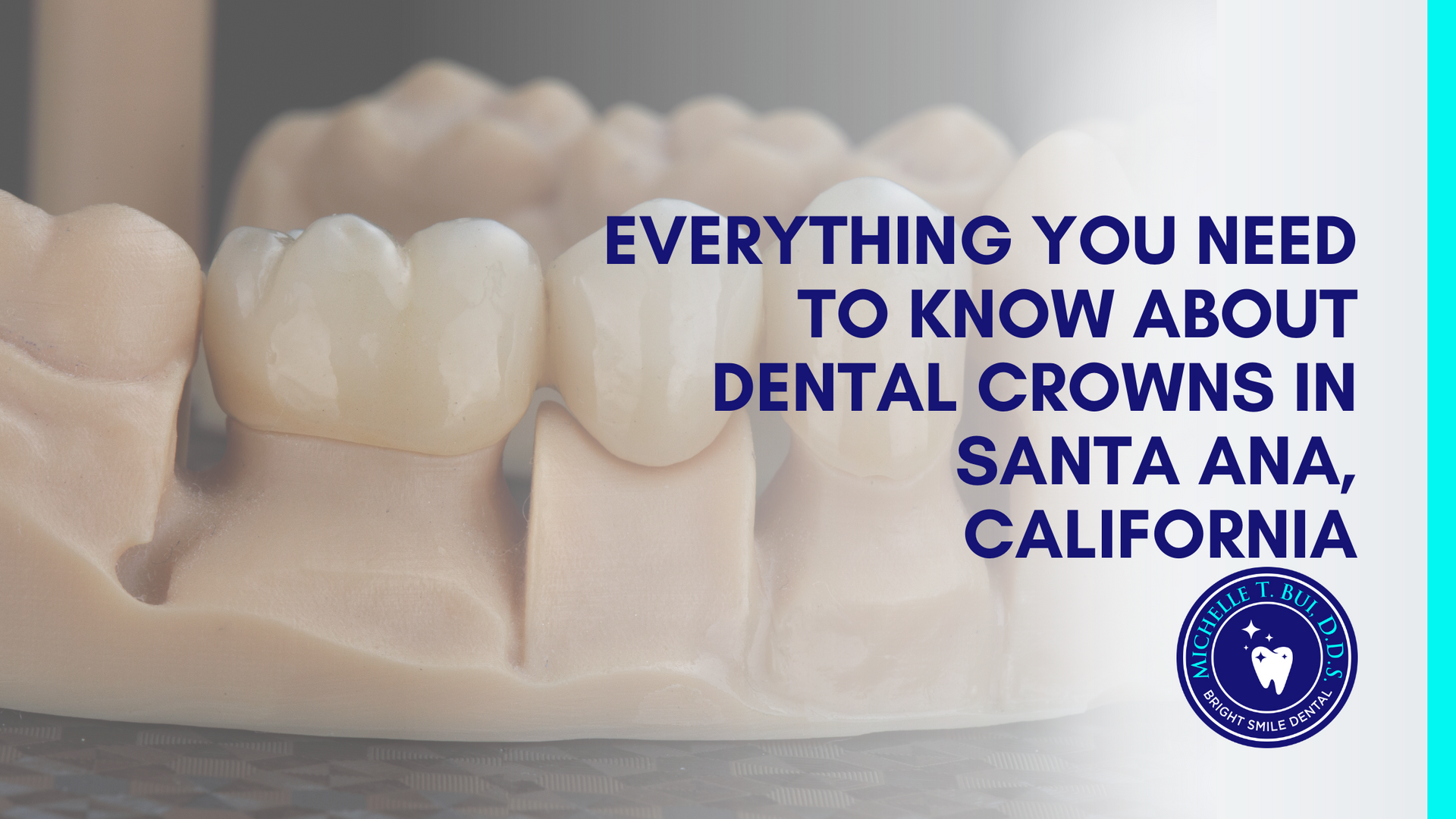 an ad for dental crowns in santa ana california