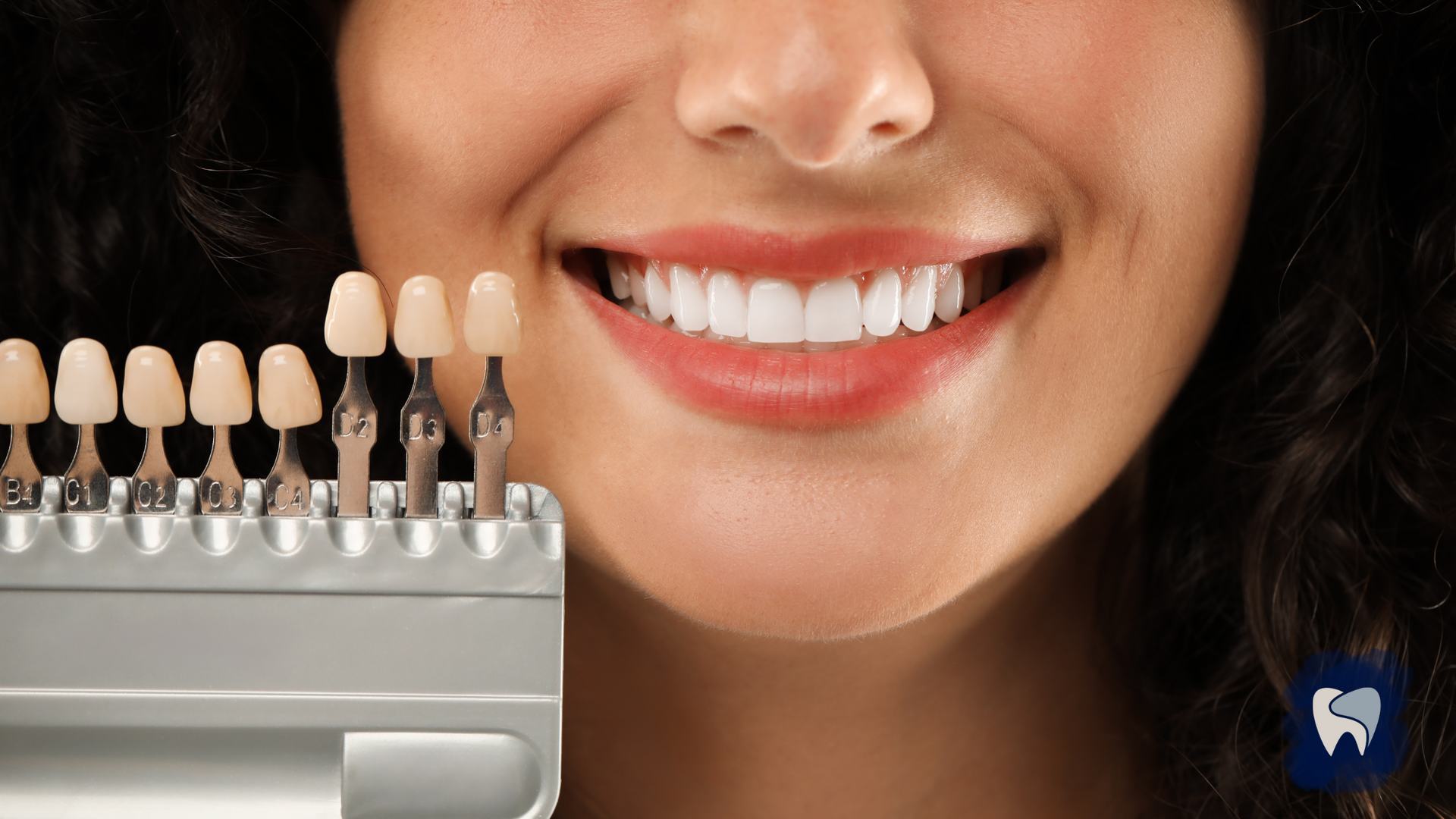 A close up of a woman 's smile next to a tooth color chart.