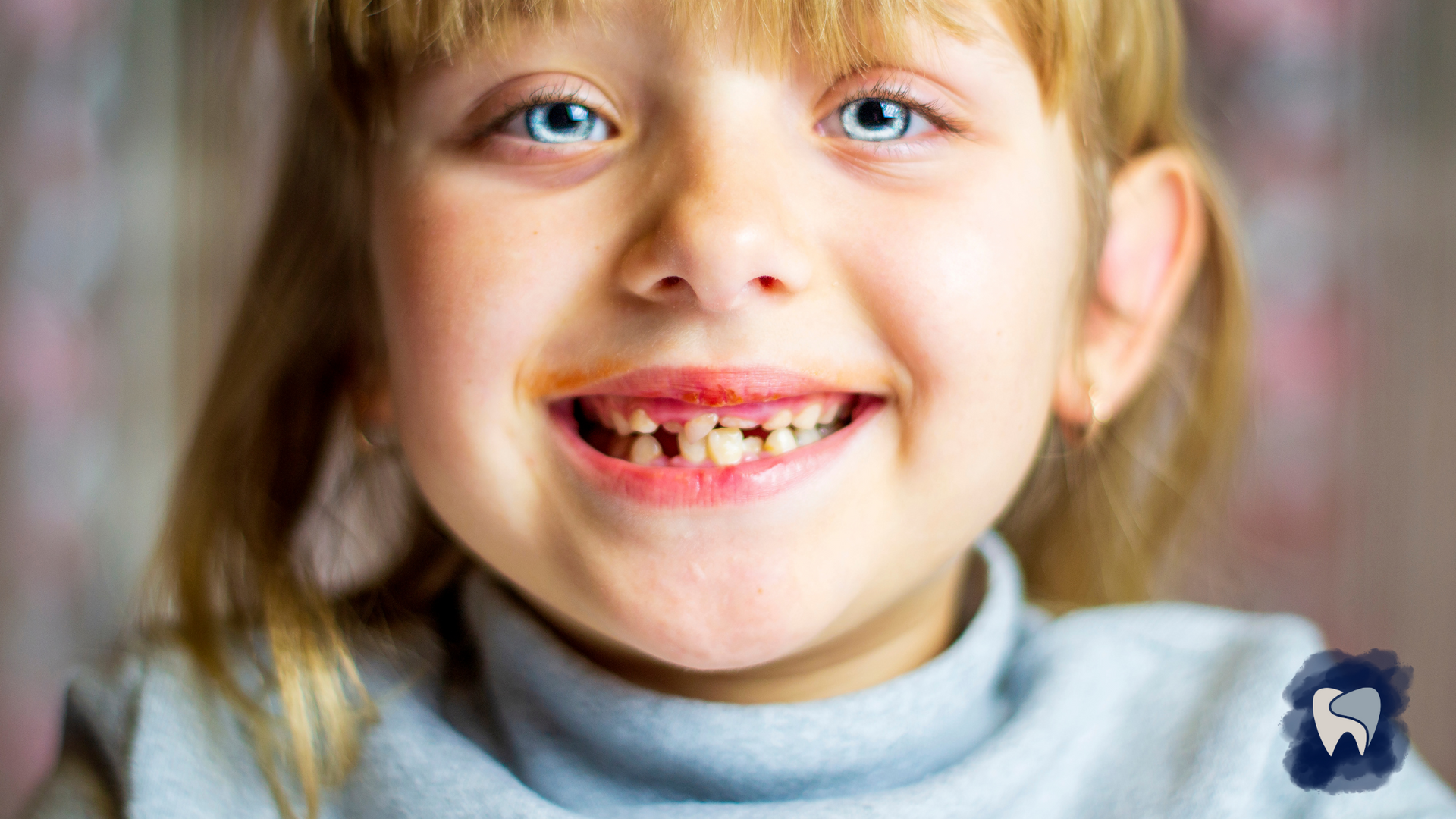 A little girl with missing teeth is smiling for the camera.