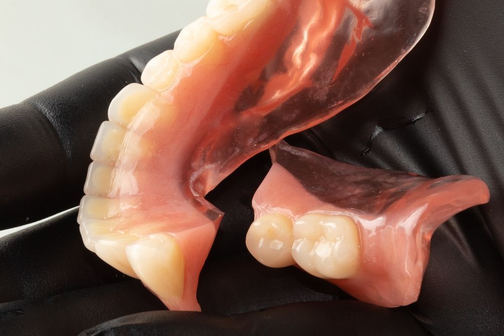 A Person is Holding a Denture in Their Hand — Maroochy Denture Clinic In Yandina, QLD