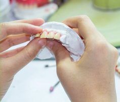 Hands holding a dental mold with a set of teeth — Maroochy Denture Clinic In Yandina, QLD