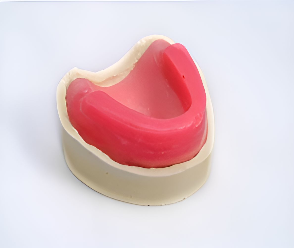A Model of a Mouth With Red Wax on It — Maroochy Denture Clinic In Yandina, QLD