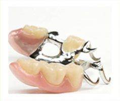 Partial dentures with pink gum-colored bases and artificial teeth, held together by a silver metal framework — Maroochy Denture Clinic In Yandina, QLD