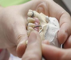 Hands working on dental model with a hook-shaped tool, the model includes teeth and pink gum material — Maroochy Denture Clinic In Yandina, QLD