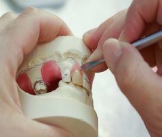 Hands shaping dental model with a sculpting tool — Maroochy Denture Clinic In Yandina, QLD