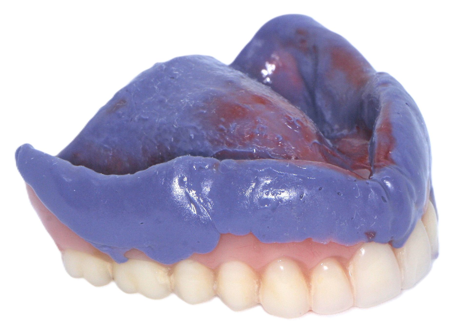 Cartoon of a man with open mouth, glasses, and dentures flying out of his mouth, hat in the air — Maroochy Denture Clinic In Yandina, QLD