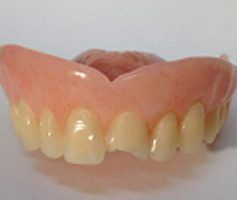 Dentures: Pink plastic base with off-white teeth; one central tooth appears broken — Maroochy Denture Clinic In Yandina, QLD
