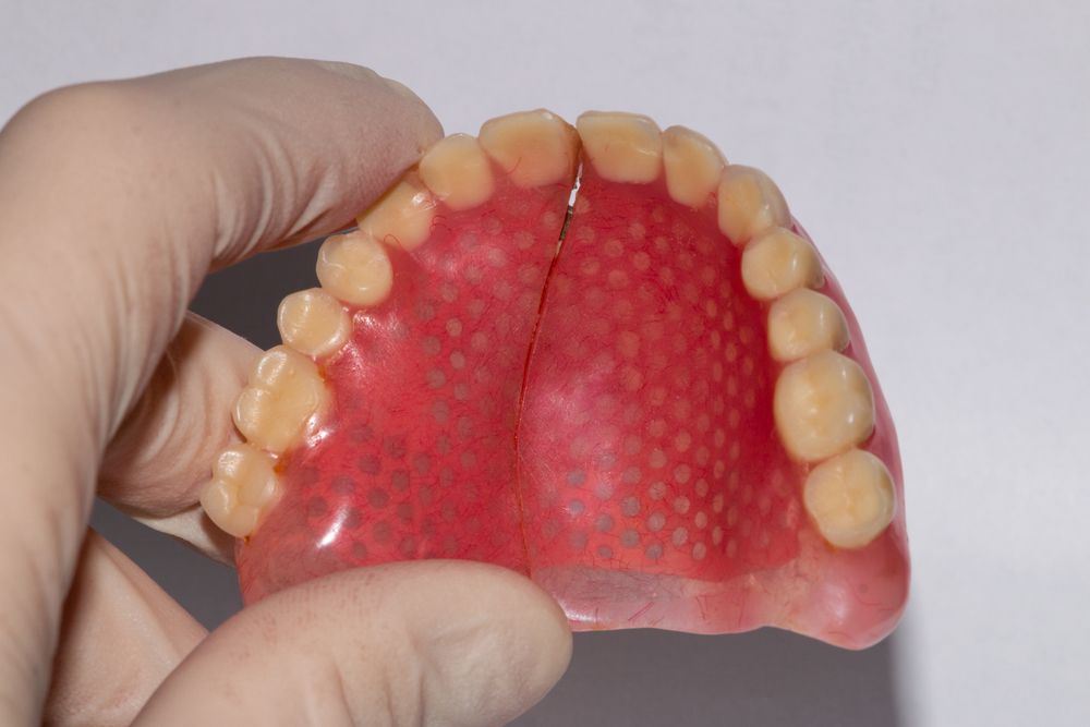 Hand Holding a Cracked Upper Denture With Pink Base — Dentures Direct Ballina In Ballina, NSW