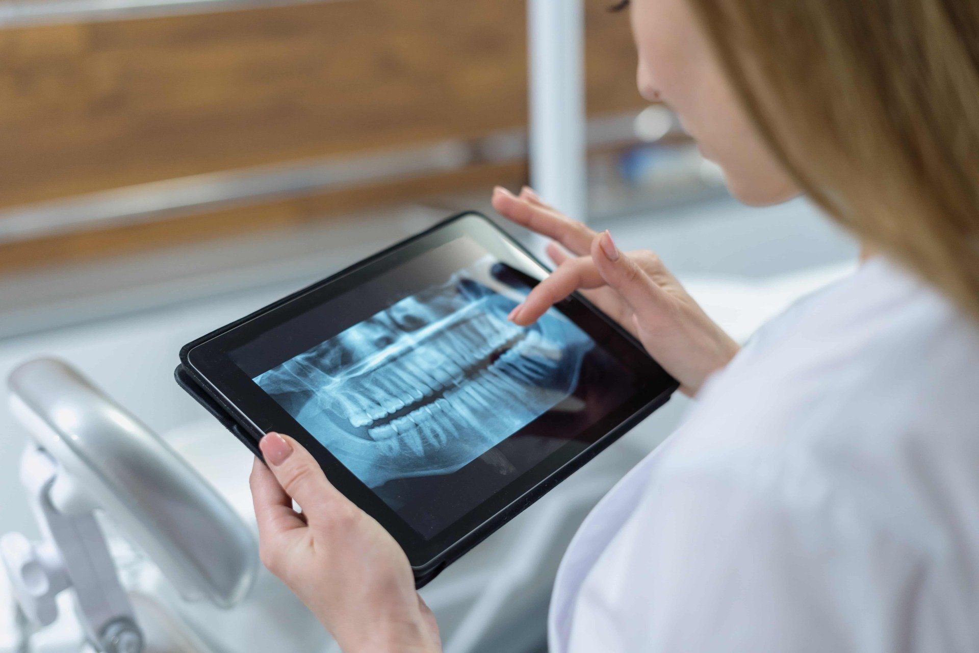 X-Ray