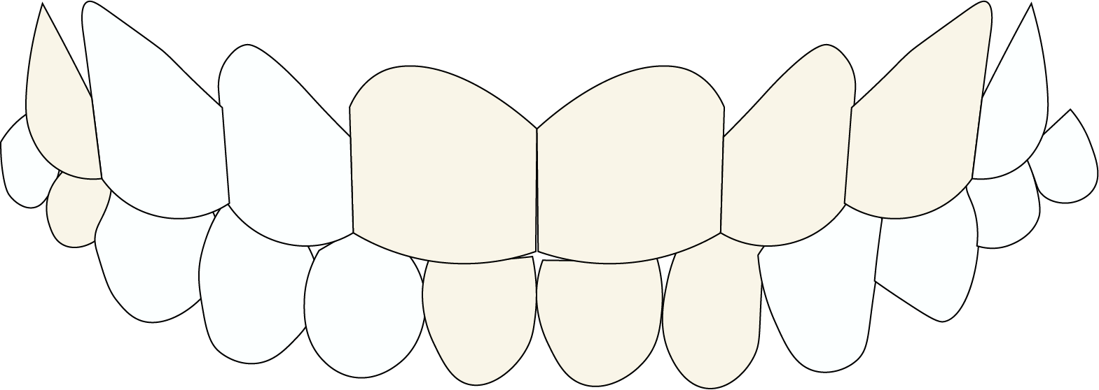 STAINED TEETH