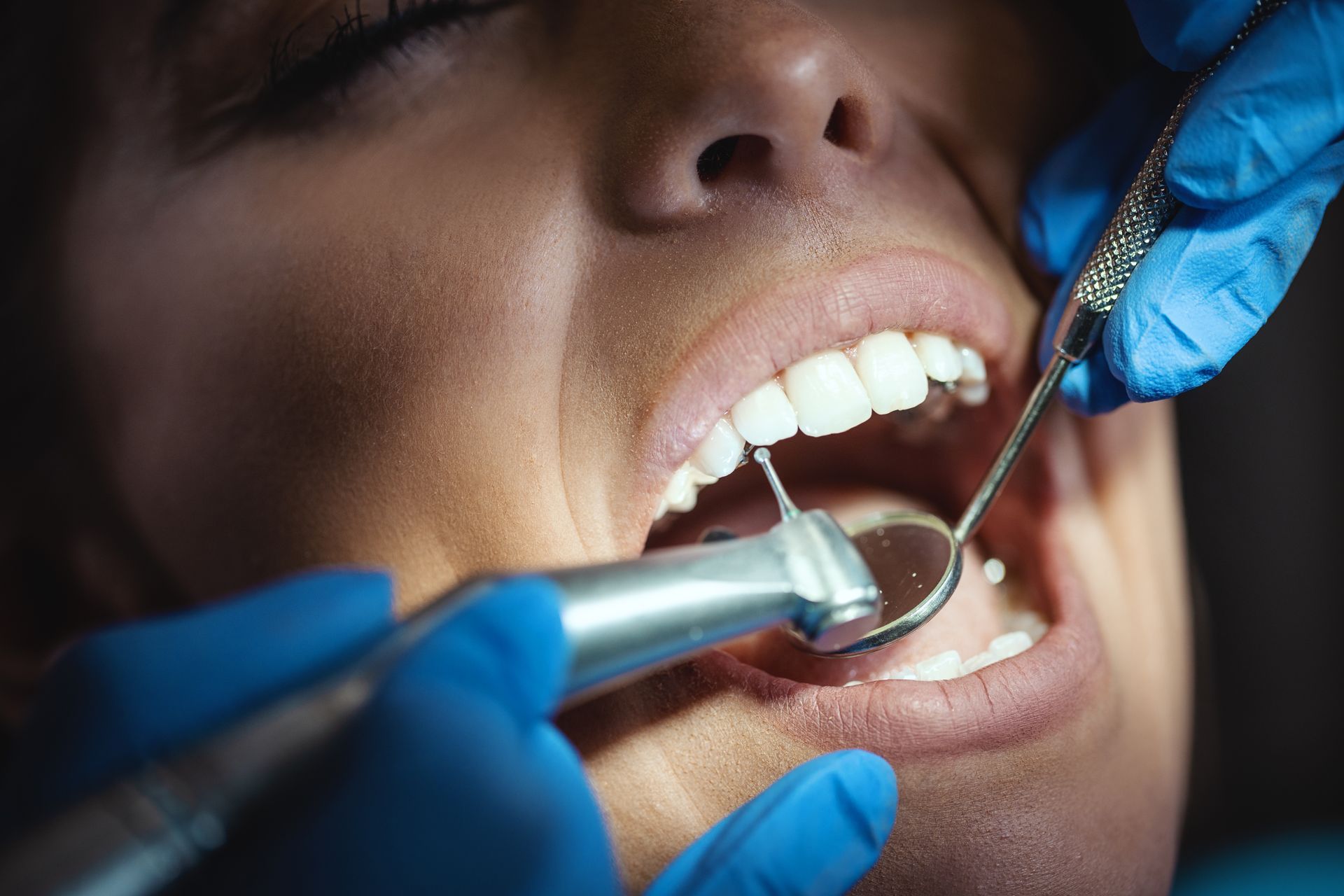 Dentist examining teeth with a mirror and drill; hands in blue gloves.