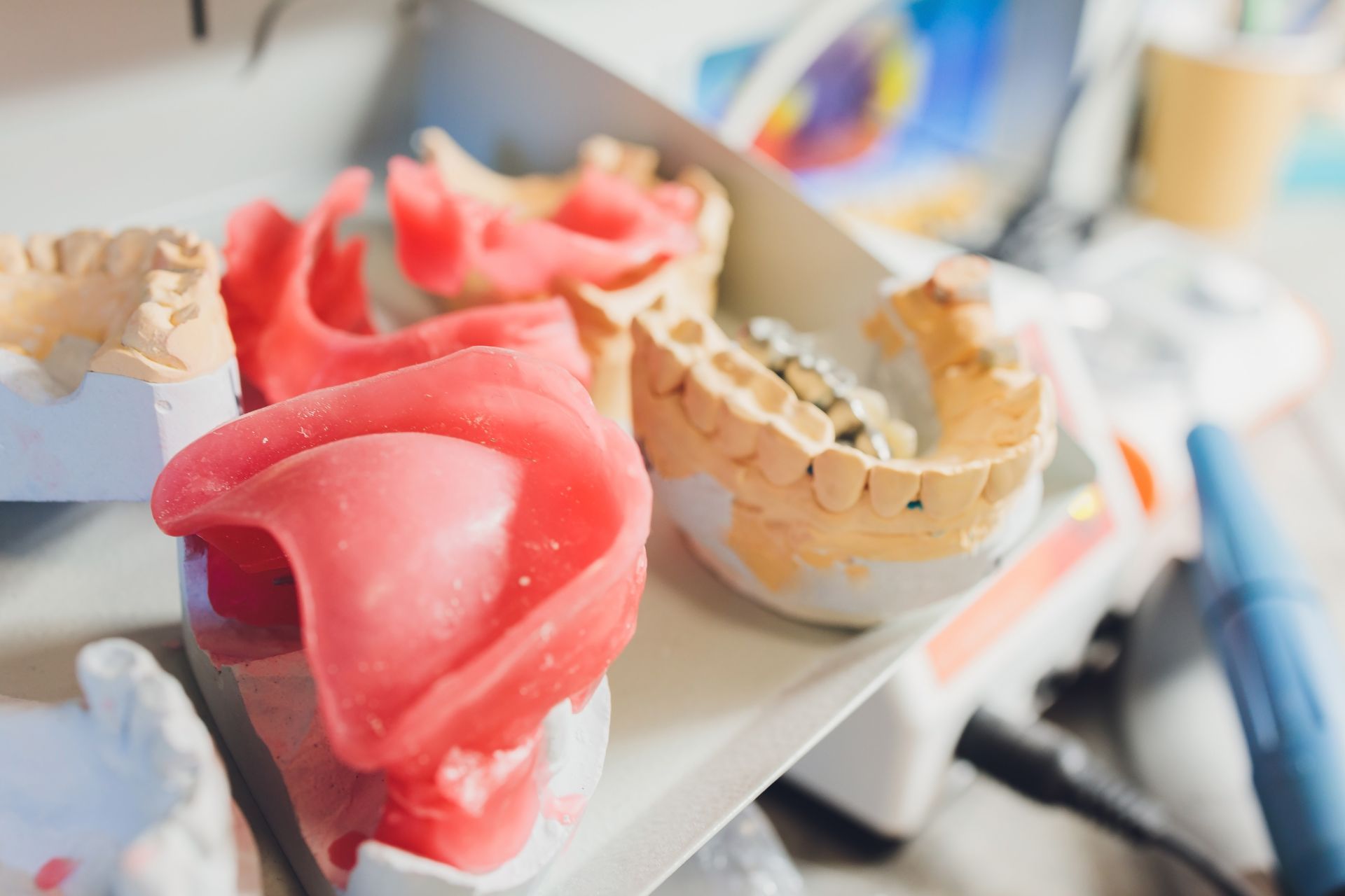 Dental molds in various stages of creation, with pink and white materials in a dental lab.