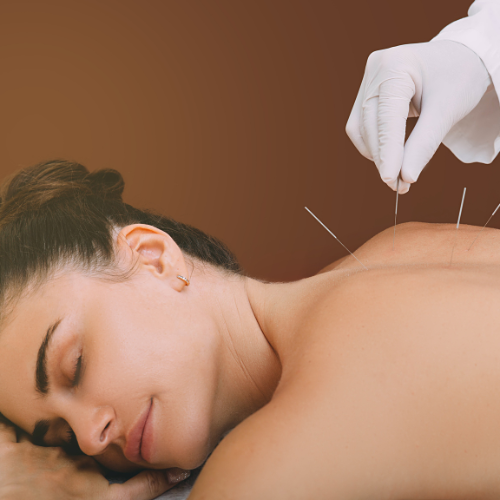 Person receiving acupuncture