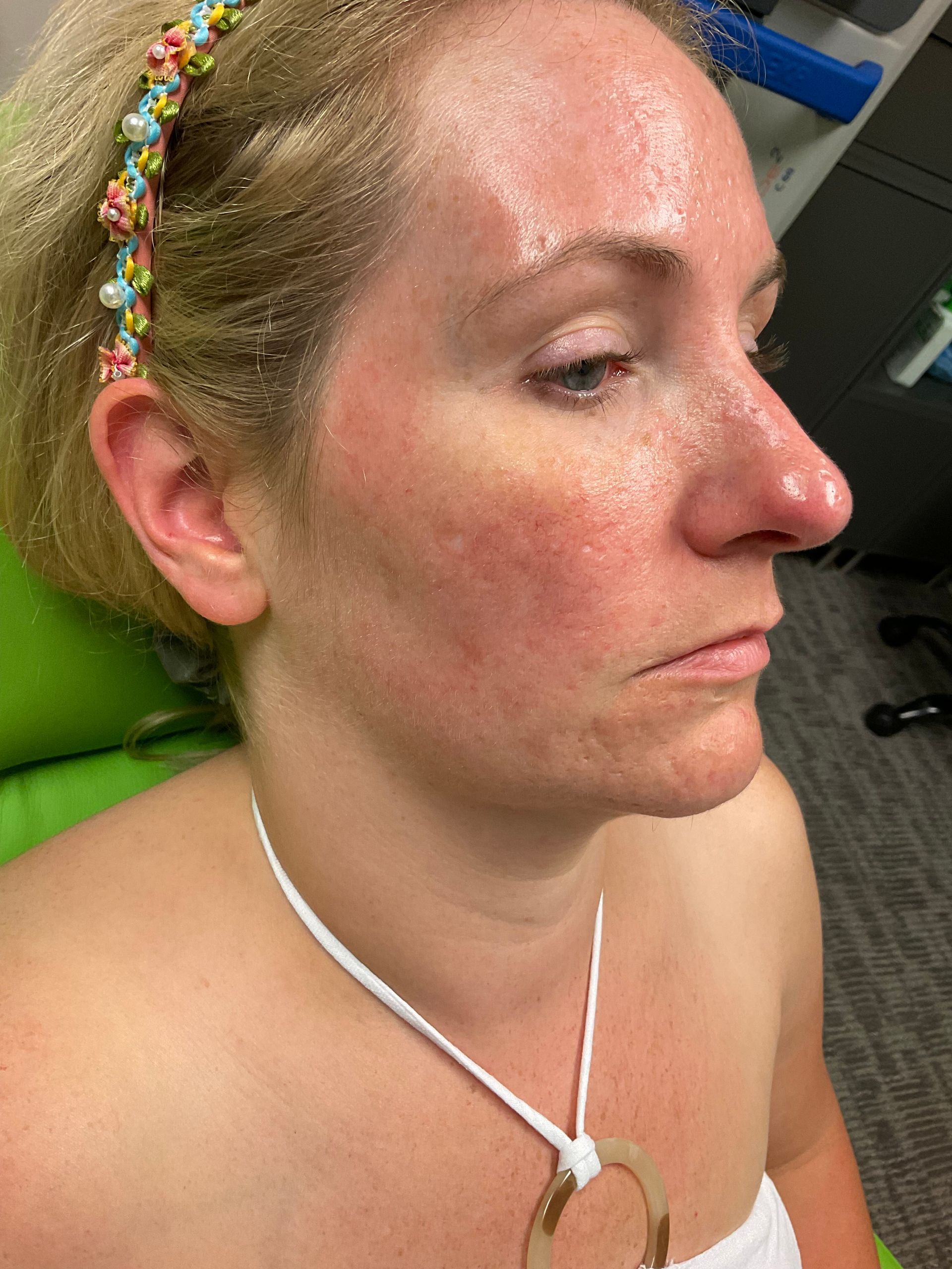 A woman with a headband on her head and a necklace around her neck.