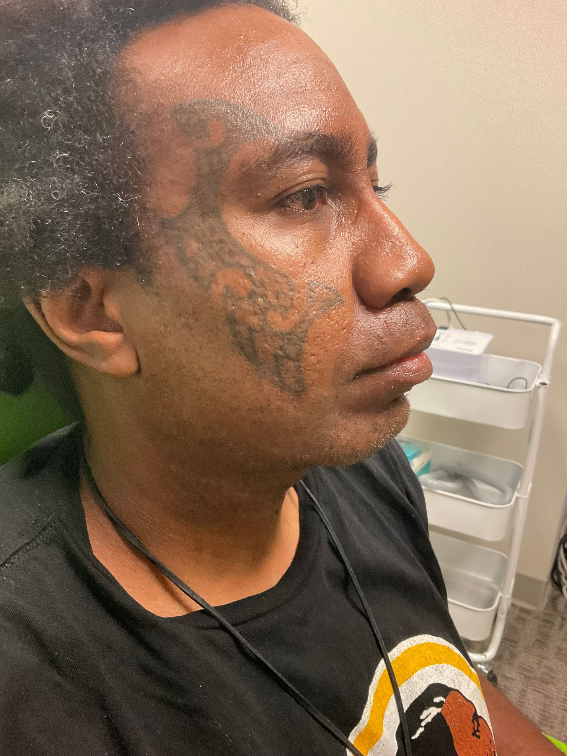 Man with face tattoo, in a doctor's office. He has dark skin and a neutral expression.
