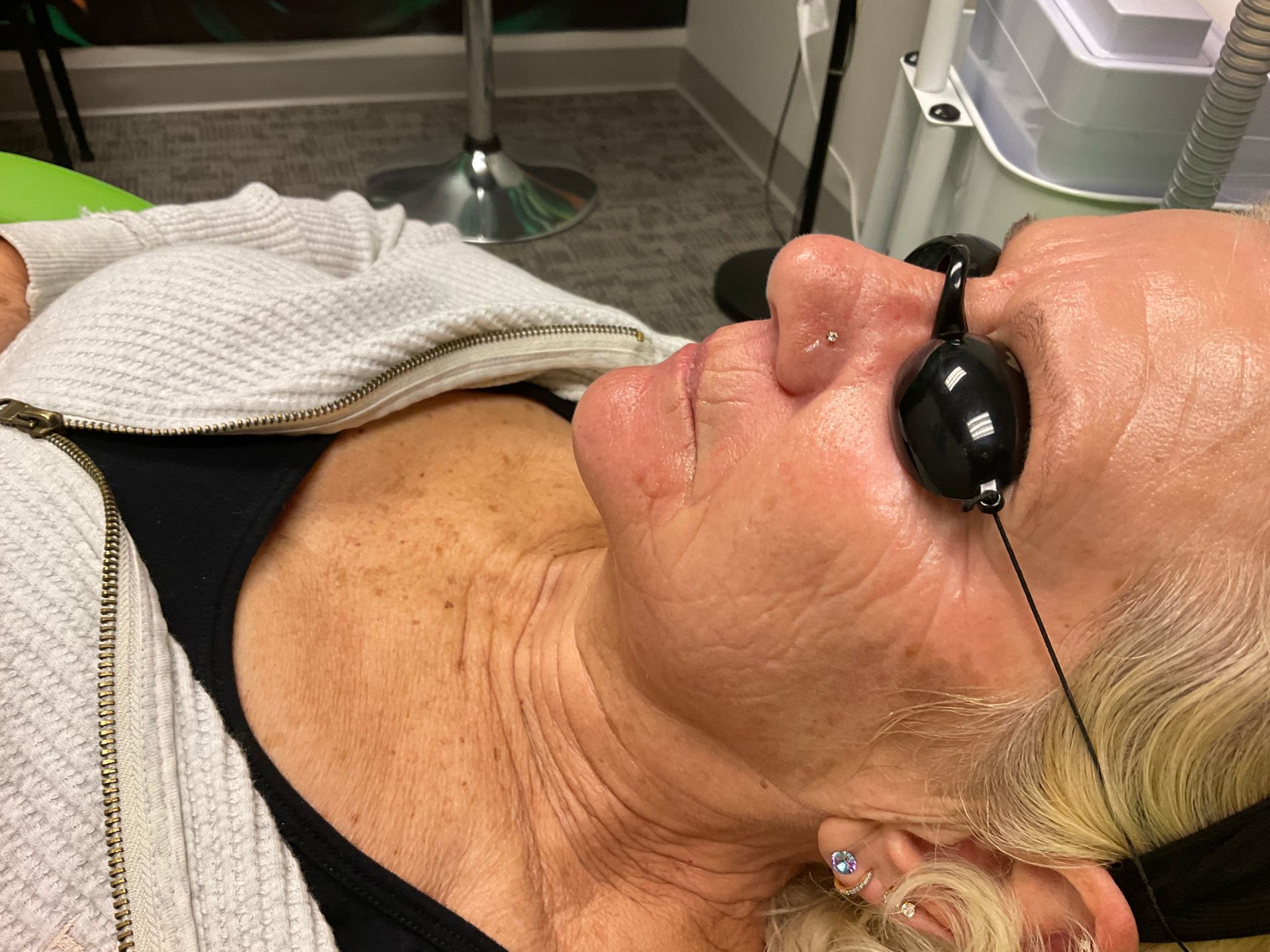 Person wearing eye protection during a facial procedure in a treatment room.