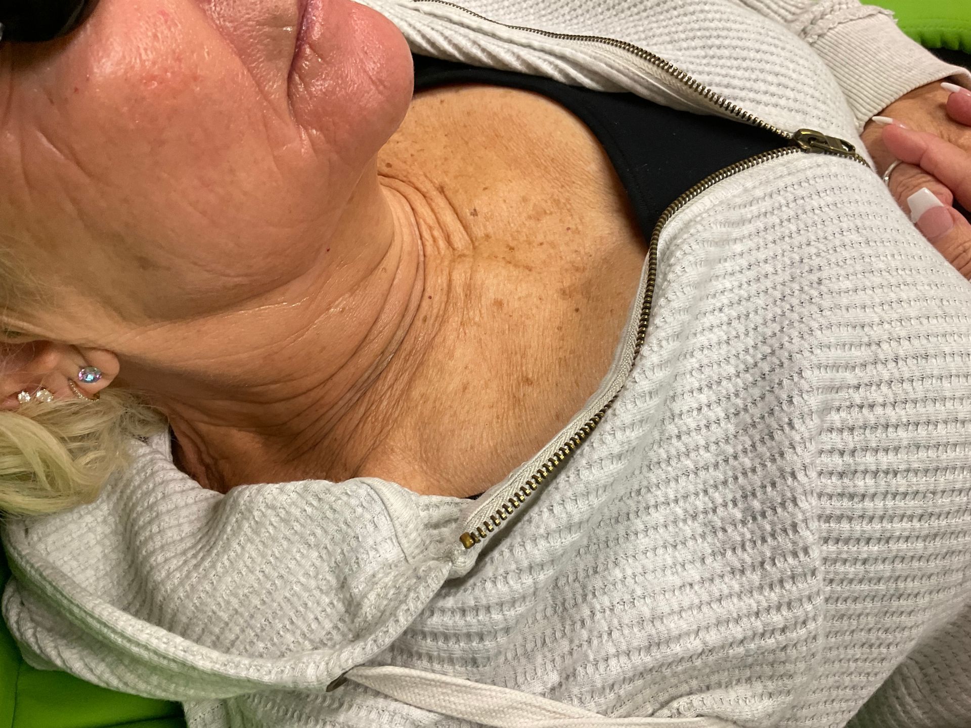 Close-up of a person's neck and chest, showing wrinkles and sunspots, wearing a light gray zipped hoodie.