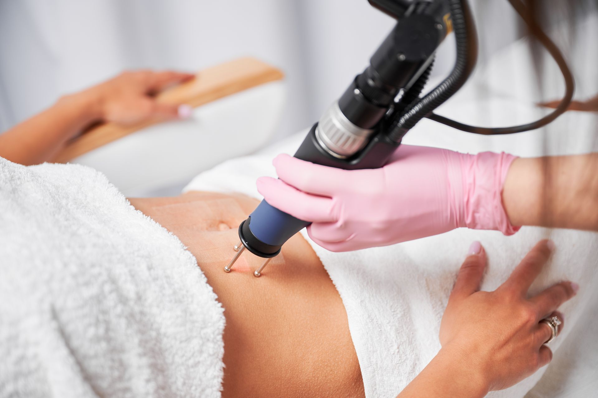 female beautician performing laser skin resurfacing on a client's belly