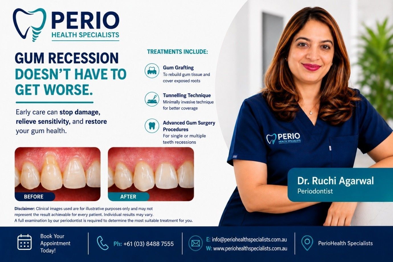 Perio Health Specialists ad with dentist, dental implant model, and “Specialist Periodontist Near Mornington” text