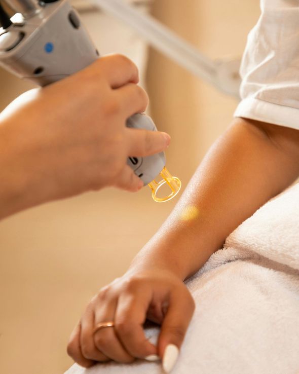 A woman is getting a laser treatment on her arm
