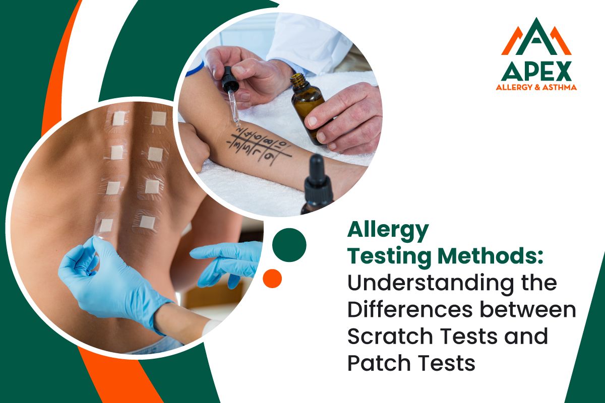 allergy tests
