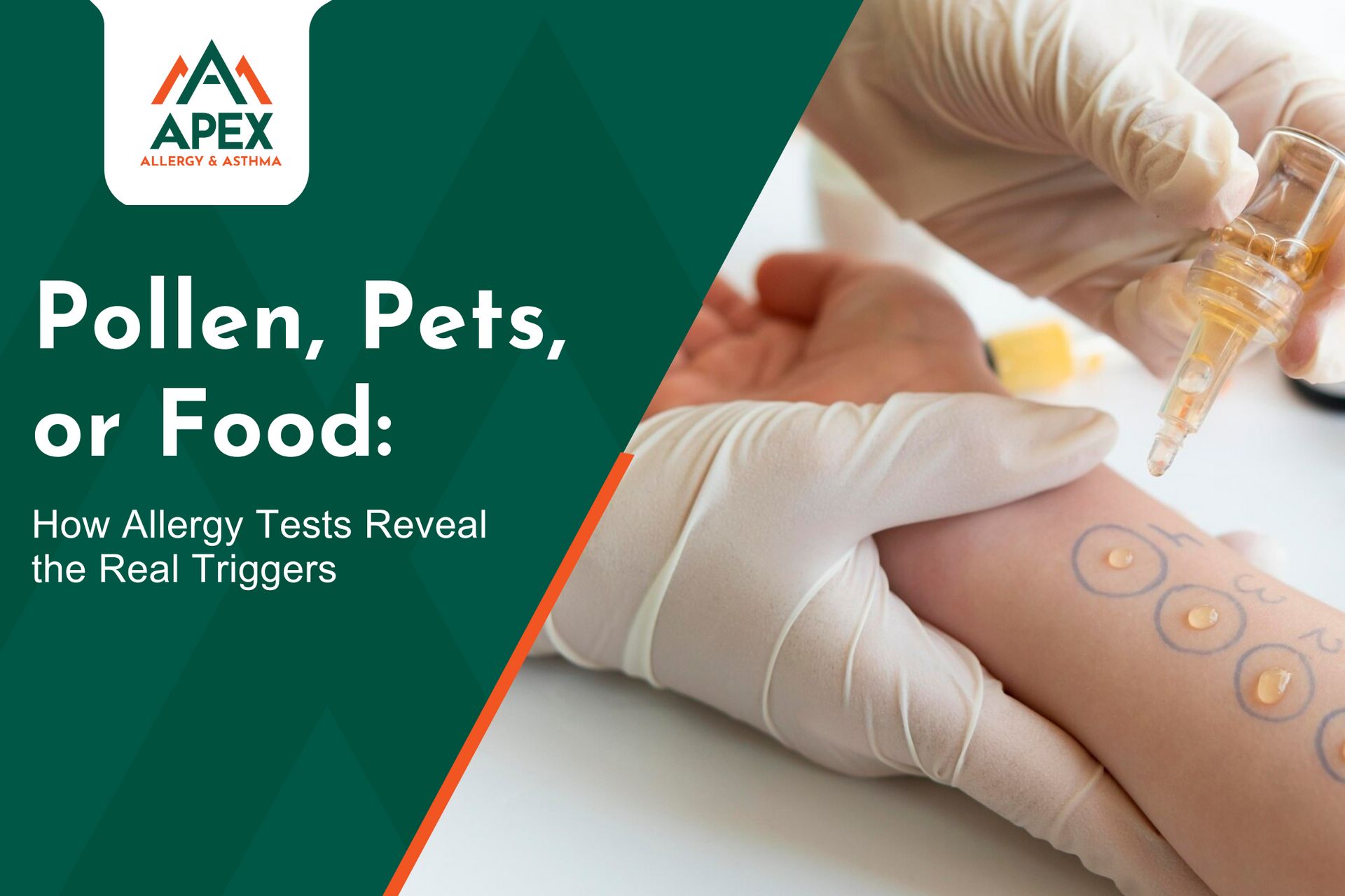 A doctor performing a skin prick food allergy test on a patient’s arm at a San Antonio clinic